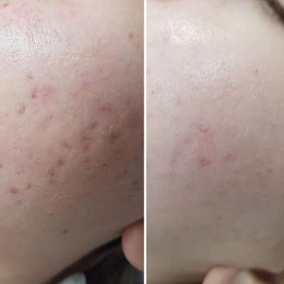 ARKANA A-QS Hacker Day Cream Krem Na Dzień Regulujący Mikrobiom Skóry 50 ml